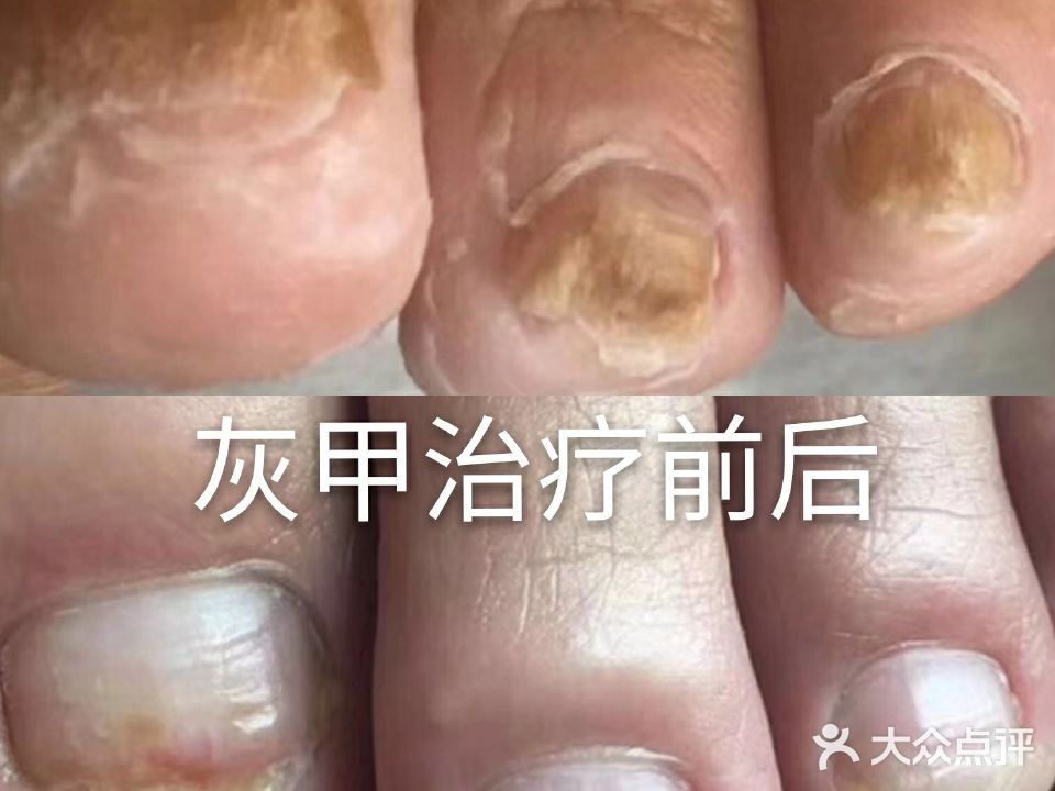 扬州修脚灰指甲手足护理(纺织南路店)
