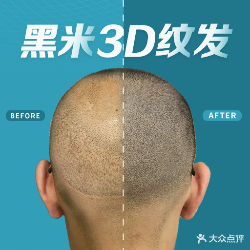 黑米纹发(广州中盈店)