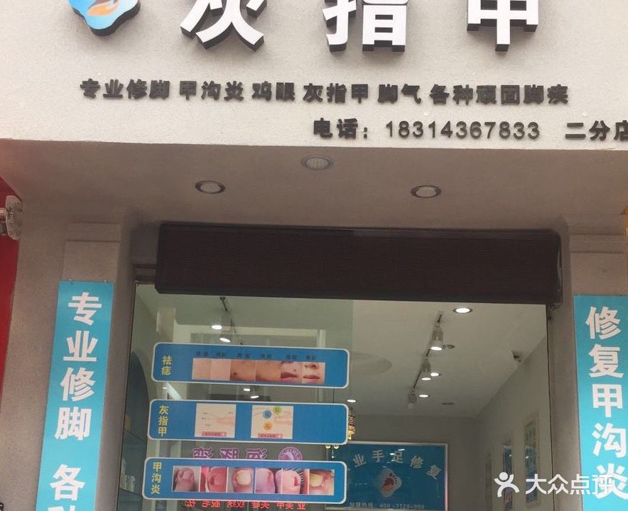 刘氏灰指甲甲沟炎修脚店(二分店)