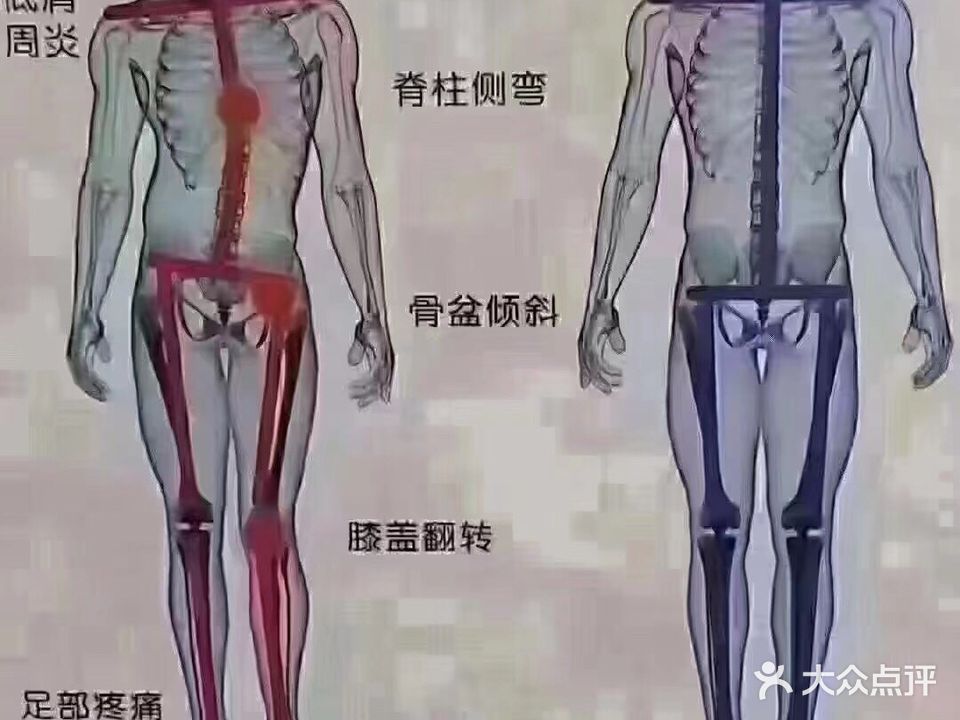 听泽筋骨理疗