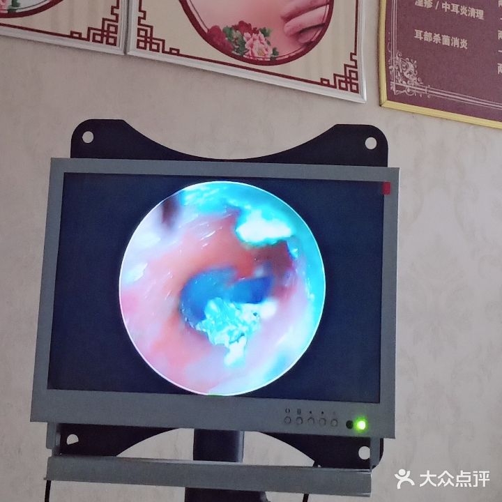 耳畔可视专业采耳