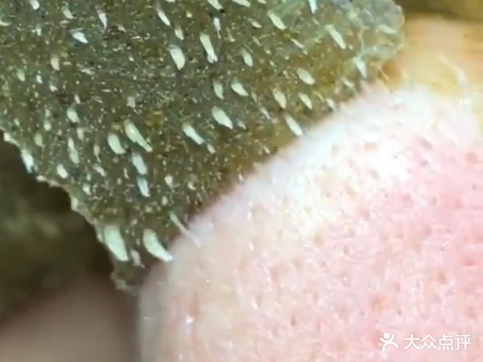 素颜美·专业祛斑祛痘