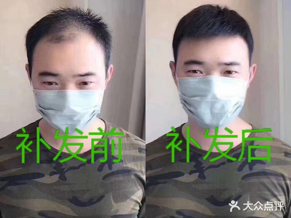 顶美补发·假发定制(中州东路工厂总店)