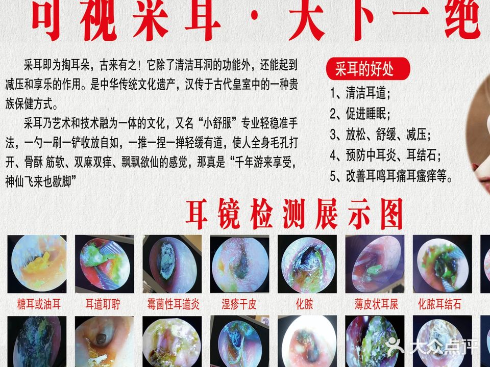 康耳舒可视采耳