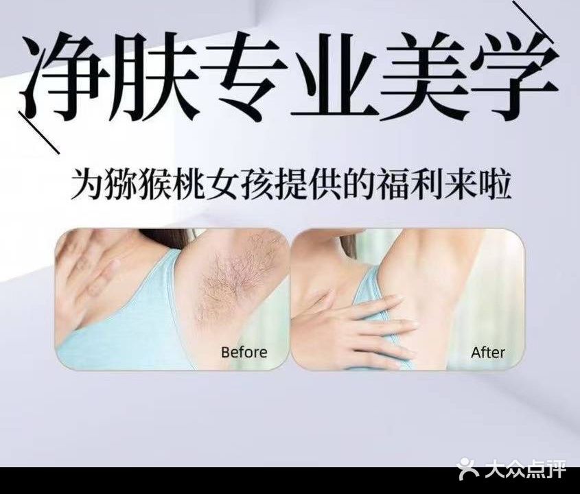 心选净肤美专业脱毛