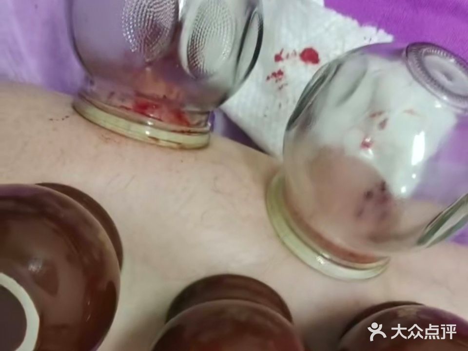 李氏推拿正骨(世纪花园店)