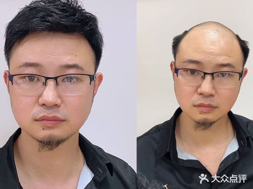 重生假发织发补发中心(龙光普罗旺斯店)